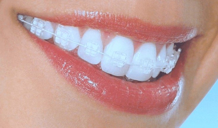 Close-up of a clinical dental device