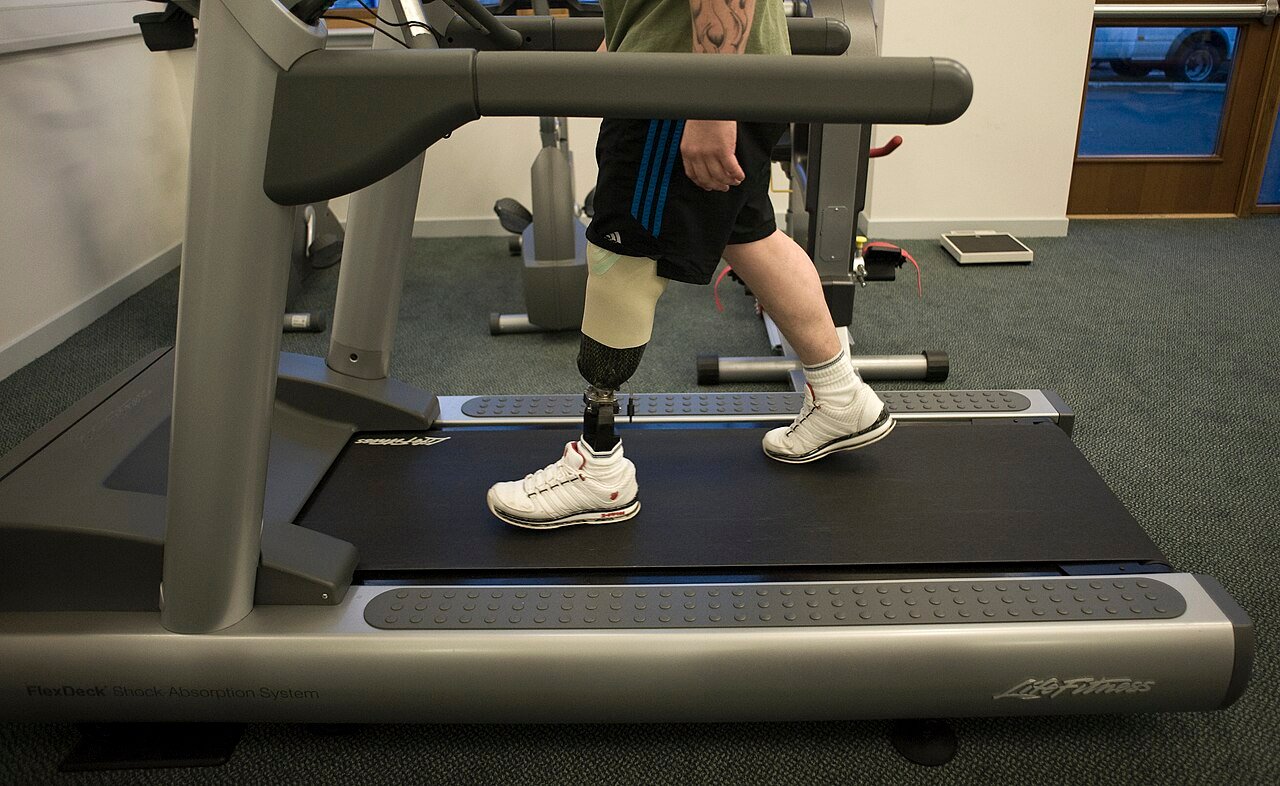 Prosthetic limb for mobility support