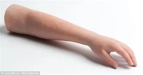 Prosthetic arm